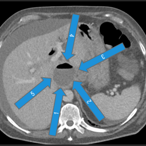 Masterclass Drainage & Biopsie, Hildesheim, 28. & 29. April 2026